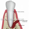 Tooth-1-1024x1024