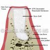 Tooth-with-infection-grafted-4-100x100